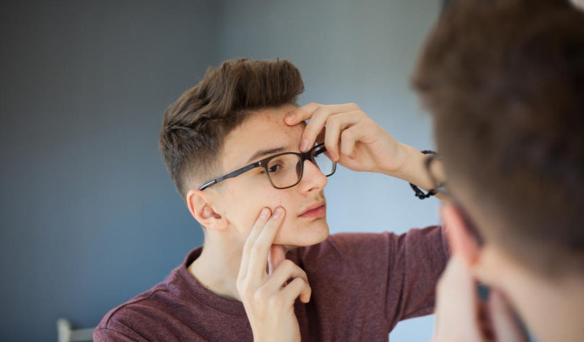 young man popping pimple young man popping pimple